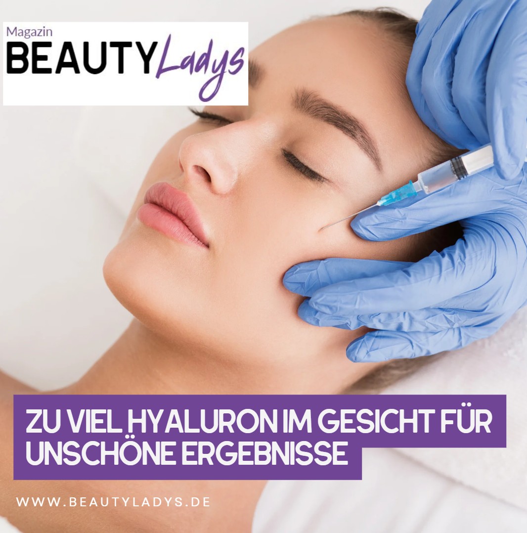 Zu viel Hyaluron im Gesicht für unschöne Ergebnisse Zu viel Hyaluron im Gesicht für unschöne Ergebnisse